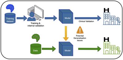 Machine learning models for diagnosis and prognosis of Parkinson's disease using brain imaging: general overview, main challenges, and future directions